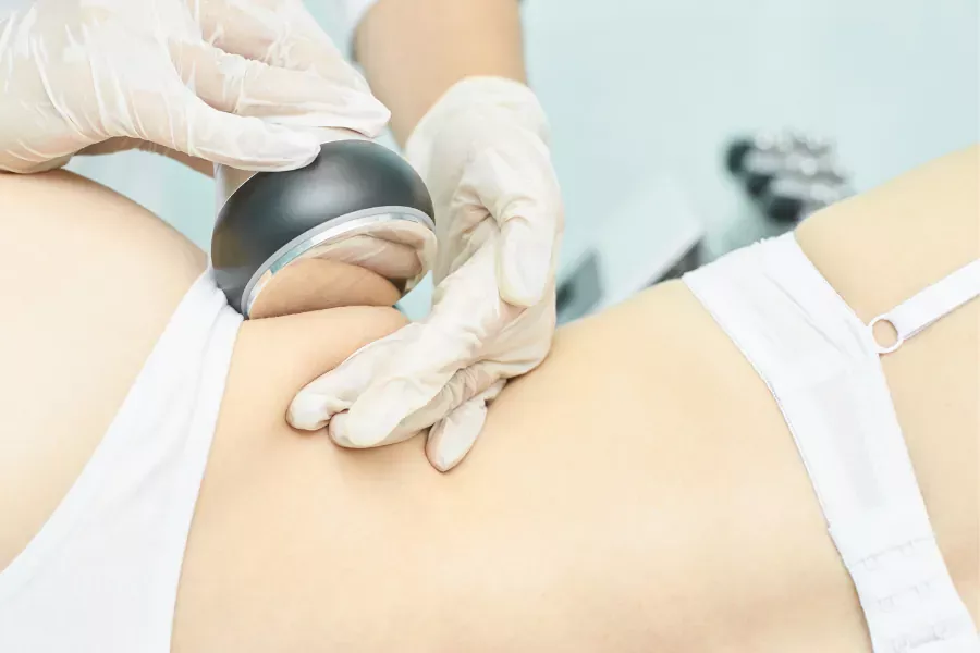 Lipocavitação na BodyBe